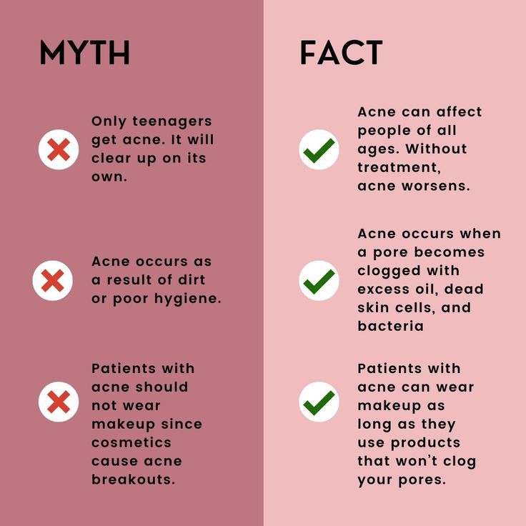 Acne Myths and Misconceptions